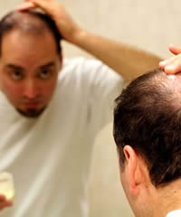 a natural cure for hair loss in men