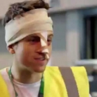  Harry Styles ‘Broke’ Greg James’s Nose Last Night